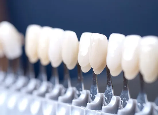 Unser Dentallabor | Hochwertiger Zahnersatz