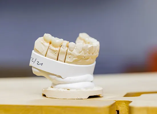 Unser Dentallabor | Hochwertiger Zahnersatz